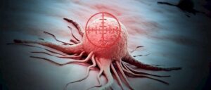 Therapie Prostatakarzinom