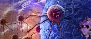 Prostatakarzinom 3 D